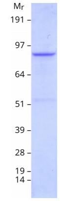 Coomassie blue staining of purified PKP2 protein.